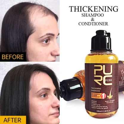 PURC-champú para el crecimiento del cabello, Control de aceite, anticaspa, picazón, tratamiento para la pérdida de cabello, crecimiento rápido, cuidado del cabello, champú de jengibre