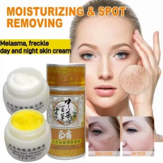 Chennongmei kit antipecas blanqueador a base de hierbas 20 g de crema para la piel de día y 20 g de noche