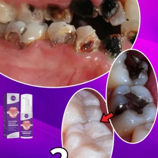 Pluma de pasta de dientes para blanquear los dientes, 3 días, elimina la placa, limpieza de manchas, higiene bucal, blanqueamiento, herramienta Dental, cuidado de los dientes con aliento fresco