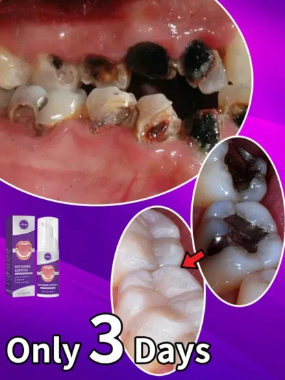 Pluma de pasta de dientes para blanquear los dientes, 3 días, elimina la placa, limpieza de manchas, higiene bucal, blanqueamiento, herramienta Dental, cuidado de los dientes con aliento fresco