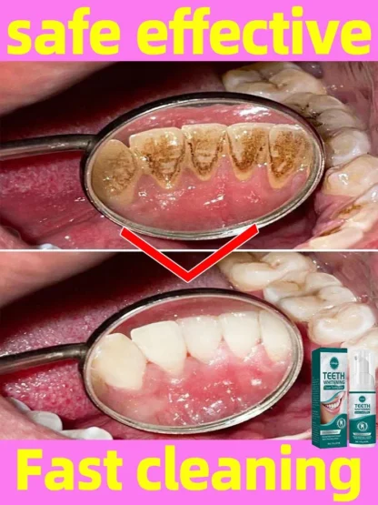 Resolver todos os problemas dentales~
