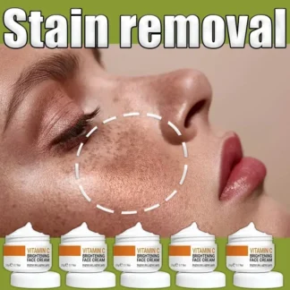 Potente eliminación de manchas oscuras cloasma manchas de edad manchas solares esencia niacinamida suero blanqueador hidratante aclaramiento cuidado de la piel