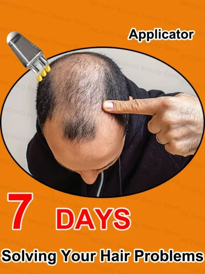 Mejora el problema del adelgazamiento de tu cabello.