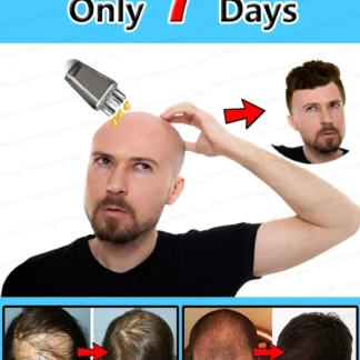 Resuelve tus problemas del cabello