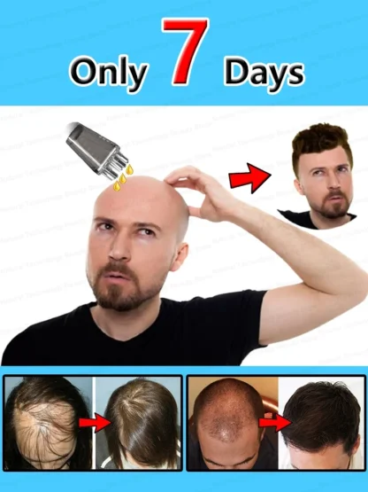 Resuelve tus problemas del cabello