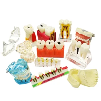 Modelo de enseñanza Dental de caries, modelo de descomposición, modelo de diente Dental Oral, decoración de enseñanza para blanqueamiento Dental