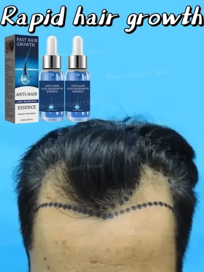 Transforme su cabello fino con este Miracle Elixir