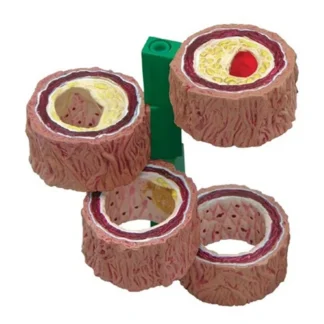 Modelo de arteria de 4 piezas de cuerpo humano, réplica anatómica, modelo de esclerosis y trombos