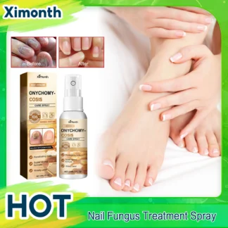 Tratamiento de hongos en las uñas, reparación en aerosol, sequedad, grietas, infección, cura, uñas suaves, engrosamiento, antiinfección, paroniquia, onicomicosis