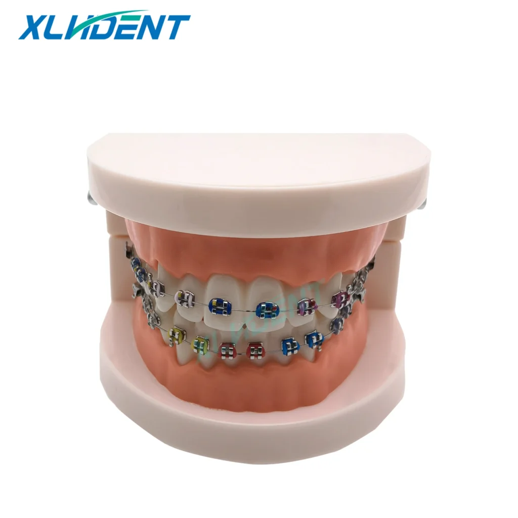 Modelo de tratamiento de ortodoncia Dental con soporte de Metal, ligaduras de alambre de arco, modelo de entrenamiento Dental, modelo Dental educativo