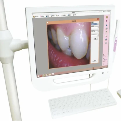 YY-HD-C Sistema de cámara intraoral y ordenador HD 1280*1024 de 17 pulgadas con pantalla resistiva táctil