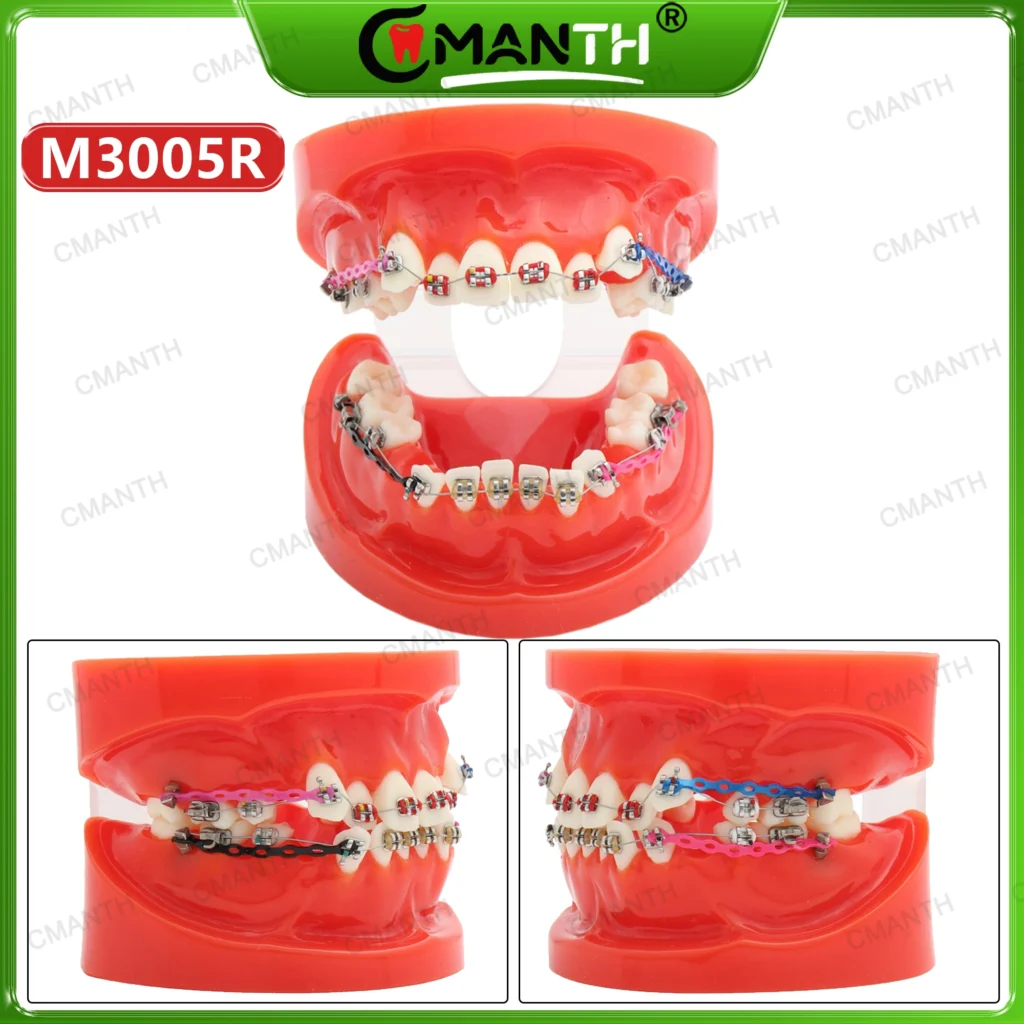 Modelo de dientes dentales con soporte de ortodoncia, tubos, ligadura, cadena de amarre, modelo de enseñanza apto para tratamiento de dentista, entrenamiento de demostración M3005R