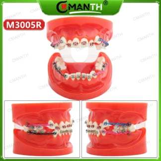 Modelo de dientes dentales con soporte de ortodoncia, tubos, ligadura, cadena de amarre, modelo de enseñanza apto para tratamiento de dentista, entrenamiento de demostración M3005R