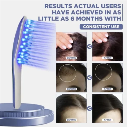 X11A Hair Growth Laser Therapy Comb, Hand-Held Low Level Device For Promoting Hair Restoration
