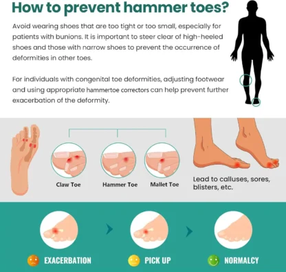 Separador de dedos de Gel de silicona de 3 tamaños, Protector de juanete Valgus Hallux, Corrector de alineación, alisador de juanete del dedo gordo, herramienta para el cuidado de los pies