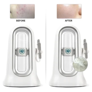 Micro burbuja eliminación de espinillas doble cabezal agua oxígeno Jet Peeling Hydra Dermoabrasión Aqua Peel belleza máquina de limpieza de la piel