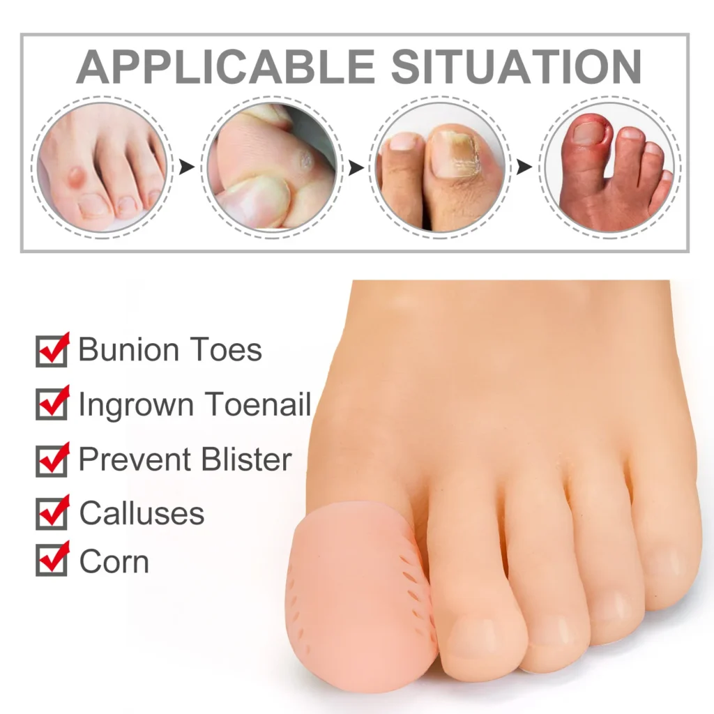 Separador de dedos grandes de silicona, Corrector de juanete, Hallux Valgus, callos, ampollas, alivio del dolor, Protector de pies, 2-10 Uds.