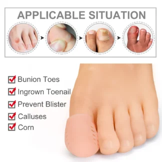 Separador de dedos grandes de silicona, Corrector de juanete, Hallux Valgus, callos, ampollas, alivio del dolor, Protector de pies, 2-10 Uds.