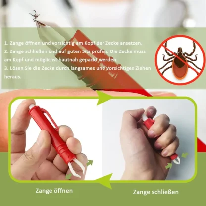 Pinzas para garrapatas A79I para perros, gatos, niños, juego de 3, ganchos para garrapatas y juego de 2, pinzas para garrapatas, eliminador de garrapatas fácil y seguro