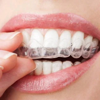 Bandejas transparentes de termoformado para blanqueamiento Dental, equipo dental, producto de blanqueamiento Dental, gran oferta, 1 unidad