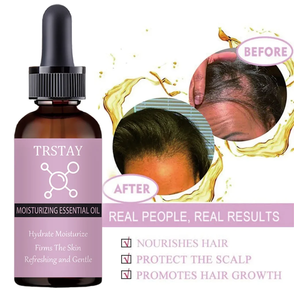 Suaviza el cuero cabelludo, reparación del crecimiento del cabello dañado, aceites esenciales, productos para el cuidado de la esencia, pérdida de cabello, restaura el cabello denso, suero líquido más grueso