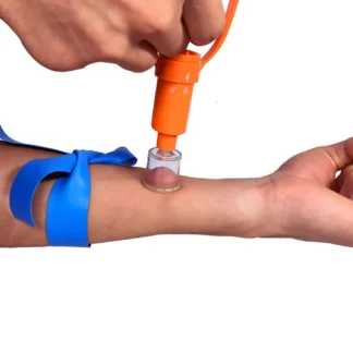 Extractor de camping para alivio de picaduras de insectos, uso manual