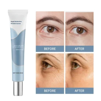 Suero hidratante para ojos, crema para ojos, masaje suave para el área de los ojos, hidratación regordeta, nutre la piel, Reduce las líneas finas, esencia para el cuidado diario de los ojos